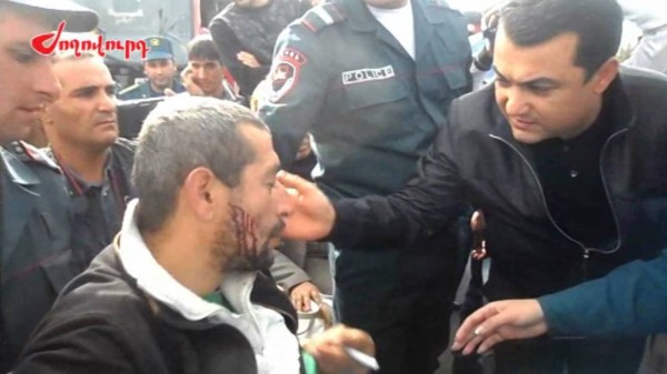 Ինքնասպանության փորձ կատարողն արձակել է բերանի կարերը և ածելին դրել բերանում (տեսանյութ)