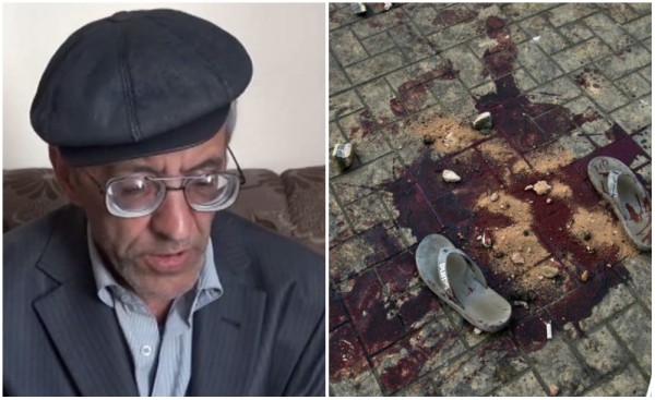 Արտառոց դեպք` Մալաթիայում. տղամարդը քնից արթնացել և իրեն արյամբ պատված է հայտնաբերել