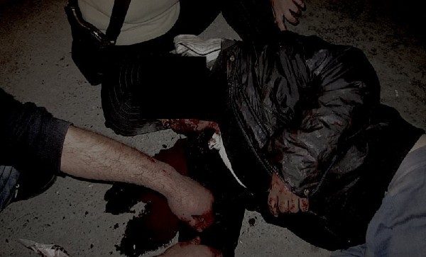 27-ամյա երիտասարդը պատմել է՝ ինչպես է կացնահարել քնած եղբորը. նոր մանրամասներ՝ Մալաթիա-Սեբաստիայում տեղի ունեցած սպանությունից