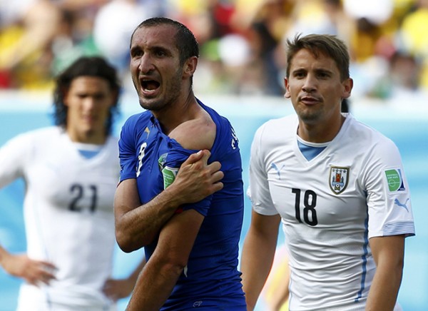 Italy's Giorgio Chiellini shows his shoulder, claiming he was bitten by Uruguay's Luis Suarez, during their 2014 World Cup Group D soccer match at the Dunas arena in Natal