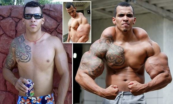 *** EXCLUSIVE - VIDEO AVAILABLE *** *** BRAZIL OUT *** *** STRICT ONLINE EMBARGO UNTIL 00:01 ON MONDAY 4/05 *** CALDAS NOVAS, BRAZIL - UNDATED: Romario dos Santos Alves before he began injecting muscle enhancer into his arms and shoulders in Caldas Novas, Brazil. Bodybuilder Romario Dos Santos Alves modeled himself on the Incredible Hulk and risked his life injecting oil into his arms. The 25-year-old turned to a cocktail of oil, painkillers and alcohol to pump up his biceps - with astounding results. Now the former bodyguard terrifies children with his super-sized muscles and is facing a catalogue serious health issues. The married dad-of-one says his experiences of using the synthetic substance cost him his sanity and nearly his life and he was even scheduled to have his arms amputated. PHOTOGRAPH BY Barcroft USA UK Office, London. T +44 845 370 2233 W www.barcroftmedia.com USA Office, New York City. T +1 212 796 2458 W www.barcroftusa.com Indian Office, Delhi. T +91 11 4053 2429 W www.barcroftindia.com