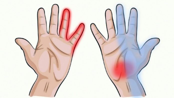 Ինչ անել, եթե Ձեր ձեռքերը հաճախ թմրում են | Armlur – Լուրեր Հայաստանից